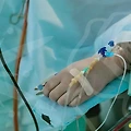 신사역 지방흡입, 마음의 준비가 필요할까?