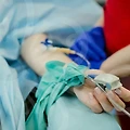 성형의 이면: 매부리코교정의 부작용과 트렌드