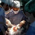성형의 그림자: 남자 코 재수술에 대한 진실과 트렌드