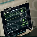 원추각막렌즈, 무엇을 알아야 할까? 🤔👁️