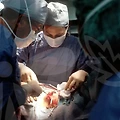 부산에서 쌍꺼풀 수술, 잘하는 곳 찾기!