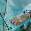성형의 세계, 당신의 결정이 두렵다면?