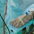 양산성형외과, 성형의 매력과 위험성에 대해 알아보자!
