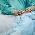 원주사각턱보톡스, 정말 필요한가?