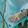 주먹코 고민, 복코교정으로 해결할 수 있을까?