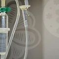 코끝연골재배치, 당신의 코는 안전한가요?