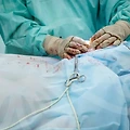 부산 리쥬란: 피부 회복의 기적?