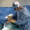 중년 눈 성형, 잘하는 곳과 수술 종류는?