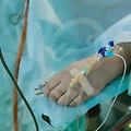 복부 지방흡입 재수술, 이런 고민 해본 적 있나요?