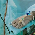 창원눈매교정, 부산성형외과에서의 새로운 시작!
