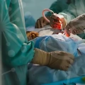 남자코수술의 최신 트렌드와 안전한 선택을 위한 실전 가이드와 사례 분석