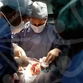 이마성형비용의 실상과 합리적 선택을 위한 최신 트렌드와 활용 팁