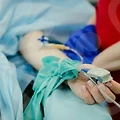 온다리프팅으로 피부 탄력과 윤곽을 개선하는 방법