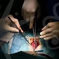 파킨슨병을 고려한 성형 수술의 안전한 선택과 최신 트렌드