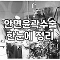 안면윤곽 수술을 고민할 때 고려해야 할 현실적인 부분들