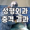 눈코성형 비용과 결과에 영향을 미치는 실질적인 요소들
