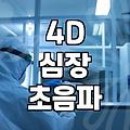 4D 심장 초음파, 혹시 나에게도 필요할까? 실제 경험자가 말하는 현실적인 장단점