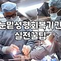 하안검 수술, 정말 필요할까요? 현실적인 고민과 경험담