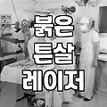 붉은 튼살 시술을 고민할 때 알아야 할 치료 시기와 레이저 선택 기준