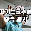 치유성형외과 방문 전 확인해야 할 상담 절차와 비용 기준