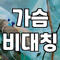 짝가슴, 수술만이 답일까? 현실적인 고민과 선택지들
