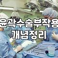 강남 성형외과 상담실을 거쳐간 사람으로서 느끼는 윤곽 수술의 현실