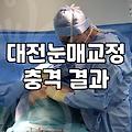둔산동성형외과 선택 시 알아야 할 실제 진료 범위와 기준