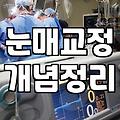 강남쌍꺼풀수술, 이것만은 꼭 알아두세요