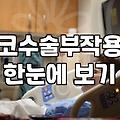 압구정 코성형, 상담실에서 듣는 말과 현실 사이의 거리
