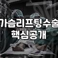 가슴처짐 고민, 리프팅 수술로 얼마나 달라질까?