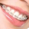 가지런한 치아의 돌출입 억제 효과
