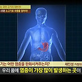 천기누설 위염 완화에 도움이 되는 소고기