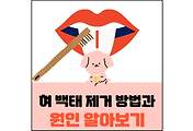 섬네일