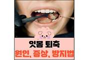 섬네일