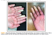 _article_related_rep_thumbnail_link_