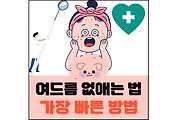 섬네일