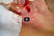 article rep thumbnail raw url