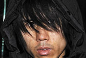 img-skin-thumnail5