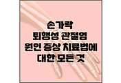 섬네일