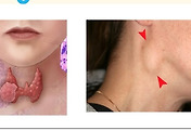 img-skin-thumnail5
