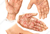 img-skin-thumnail5
