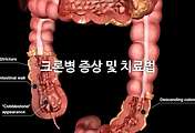 관련글이미지