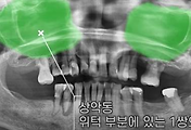 img-skin-thumnail