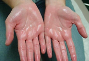 img-skin-thumnail5