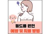 섬네일