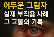 cover item thumbnail