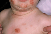 img-skin-thumnail5