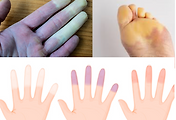 _article_related_rep_thumbnail_link_