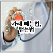 썸네일