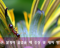 살인개미, 붉은불개미 특징, 물렸을 때의 증상 및 대처 방법